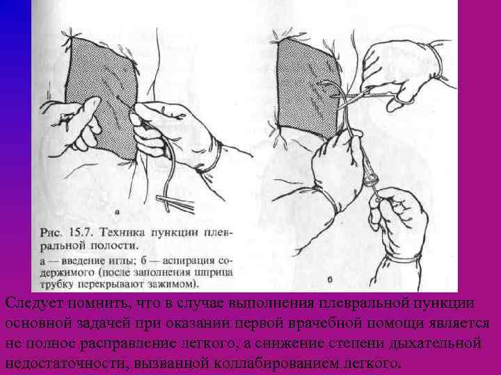 Следует помнить, что в случае выполнения плевральной пункции основной задачей при оказании первой врачебной