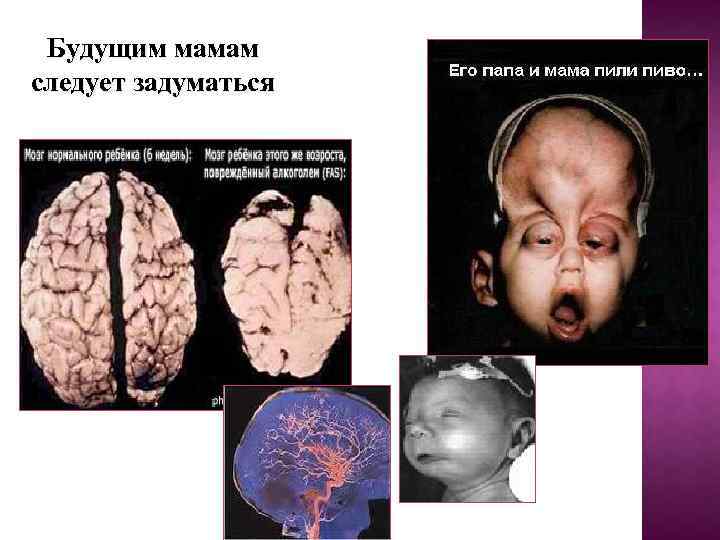 Будущим мамам следует задуматься 