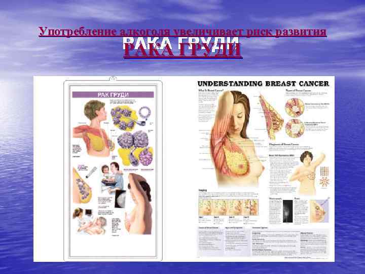 Употребление алкоголя увеличивает риск развития РАКА ГРУДИ 