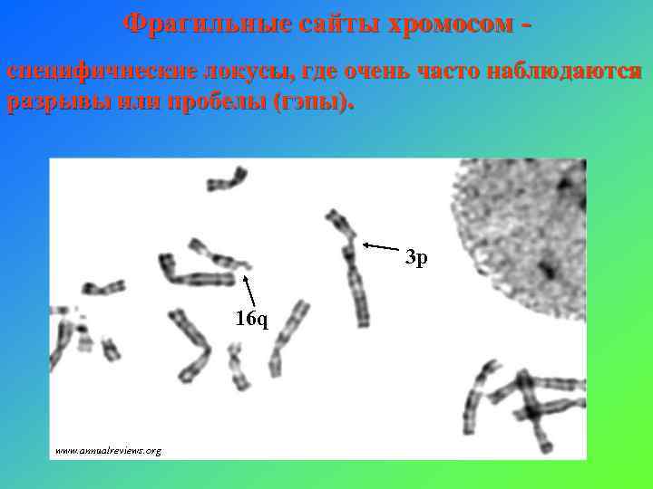 Фрагильные сайты хромосом специфичнеские локусы, где очень часто наблюдаются разрывы или пробелы (гэпы). 3