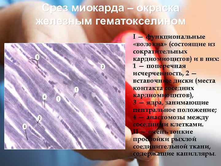 Срез миокарда – окраска железным гематокселином I — функциональные «волокна» (состоящие из сократительных кардиомиоцитов)