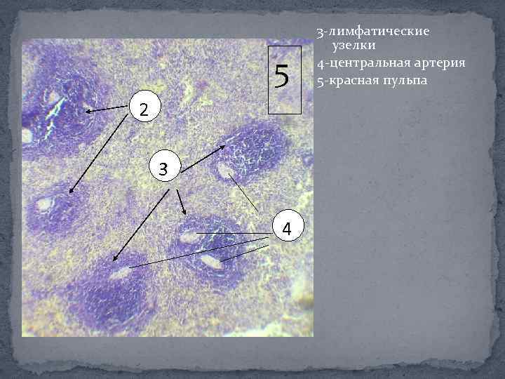 5 2 3 4 3 -лимфатические узелки 4 -центральная артерия 5 -красная пульпа 