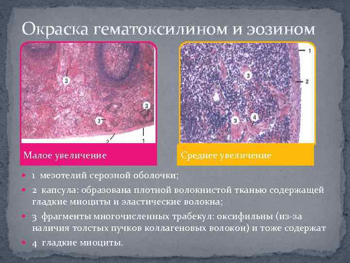 Окраска гематоксилином и эозином Малое увеличение Среднее увеличение 1 мезотелий серозной оболочки; 2 капсула: