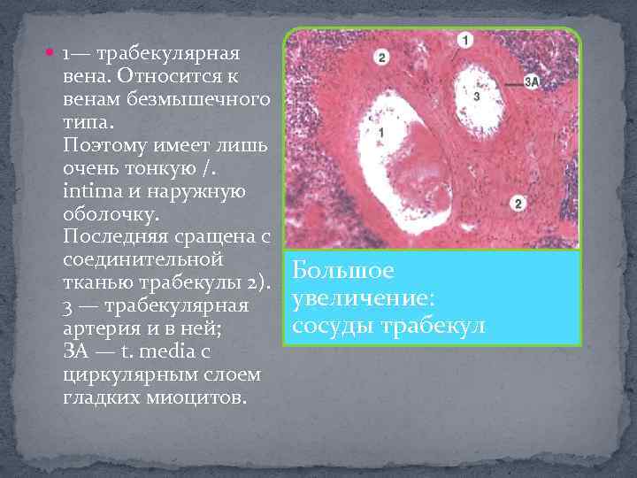  1— трабекулярная вена. Относится к венам безмышечного типа. Поэтому имеет лишь очень тонкую