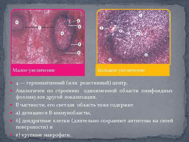 Малое увеличение Большое увеличение 4 — герминативный (или реактивный) центр. Аналогичен по строению одноименной