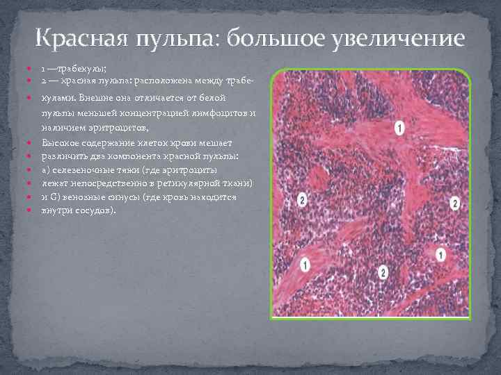 Красная пульпа: большое увеличение 1 —трабекулы; 2 — красная пульпа: расположена между трабе- кулами.