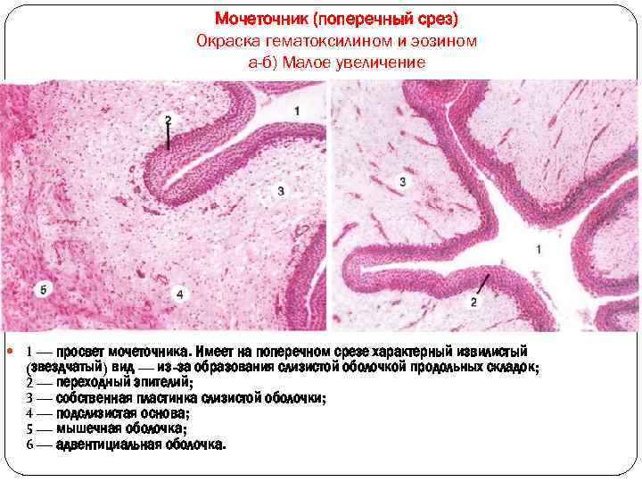  Мочеточник (поперечный срез) Окраска гематоксилином и эозином а-б) Малое увеличение 1 — просвет
