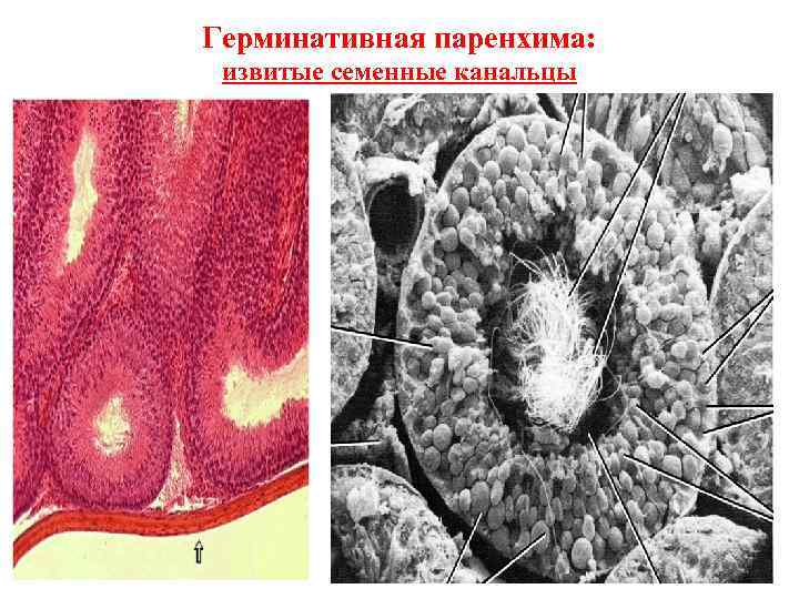 Герминативная паренхима: извитые семенные канальцы 