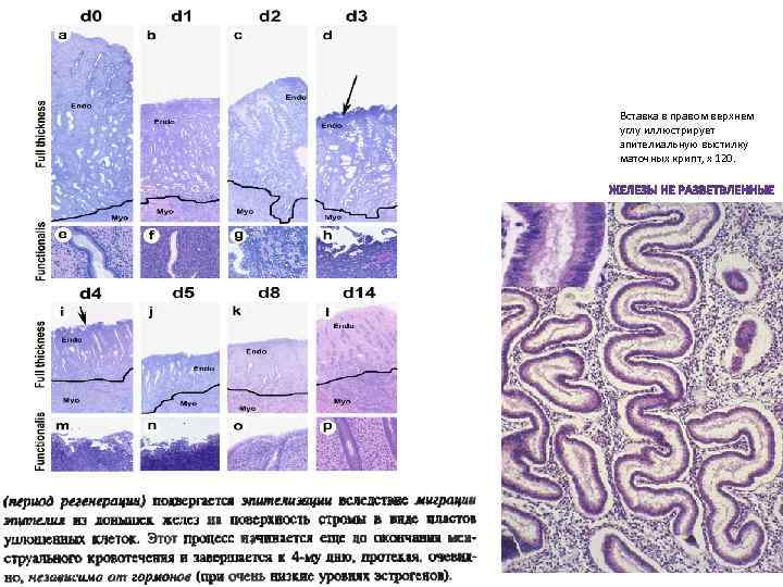 Вставка в правом верхнем углу иллюстрирует эпителиальную выстилку маточных крипт, х 120. 