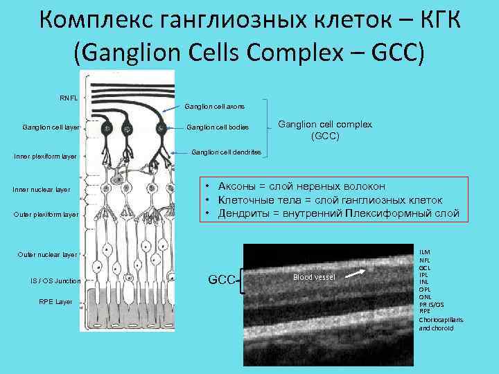 Комплекс клетка. Ганглиозные клетки. Слой ганглиозных клеток. Классификация ганглиозных клеток. Слой волокон ганглионарных клеток.