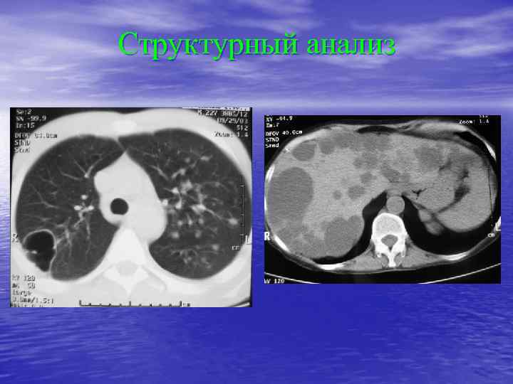 Структурный анализ 