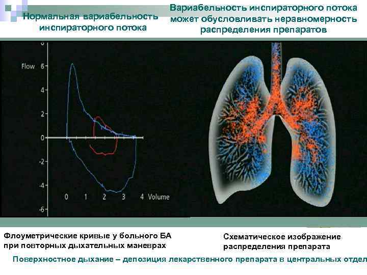 Нормальная вариабельность инспираторного потока Вариабельность инспираторного потока может обусловливать неравномерность распределения препаратов Флоуметрические кривые