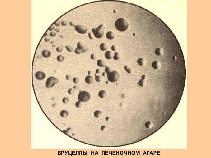 БРУЦЕЛЛЫ НА ПЕЧЕНОЧНОМ АГАРЕ 