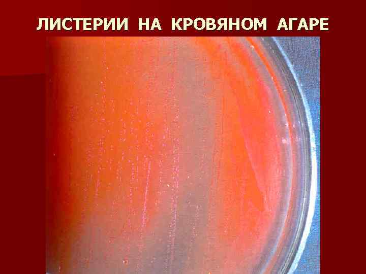 ЛИСТЕРИИ НА КРОВЯНОМ АГАРЕ 
