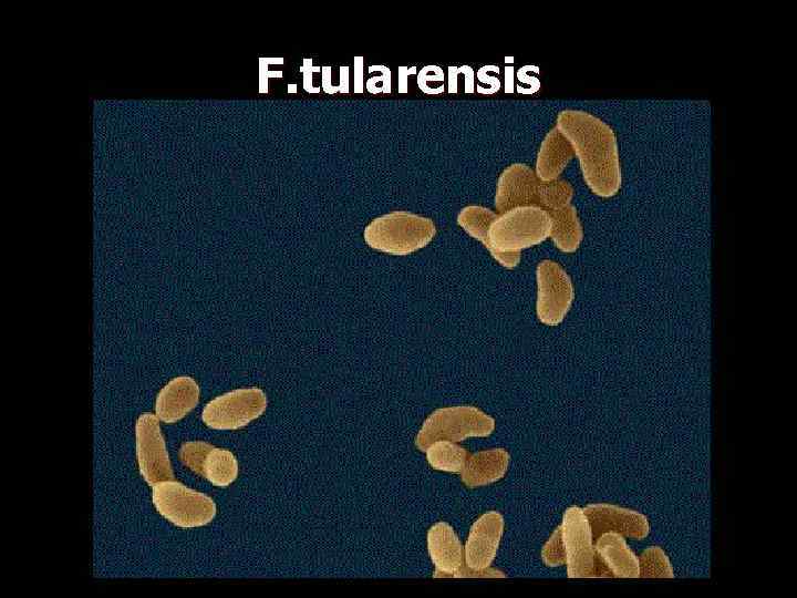 F. tularensis 