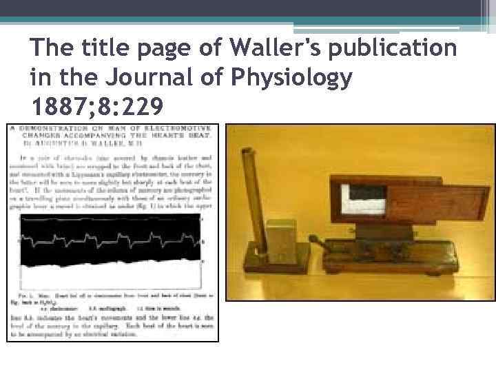 The title page of Waller's publication in the Journal of Physiology 1887; 8: 229