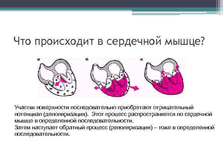 Нарушение процессов реполяризации левого желудочка. Реполяризации сердечной мышцы. Деполяризация и реполяризация это сердечной мышцы. Нарушение реполяризации по передне перегородочной. Процесс полной деполяризации сердечной мышцы.