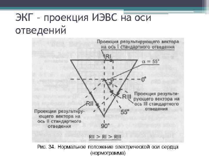 ЭКГ – проекция ИЭВС на оси отведений 