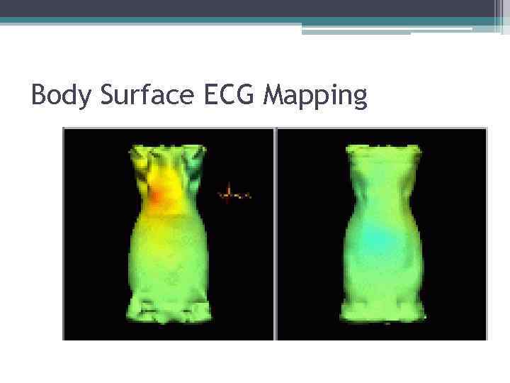 Body Surface ECG Mapping 