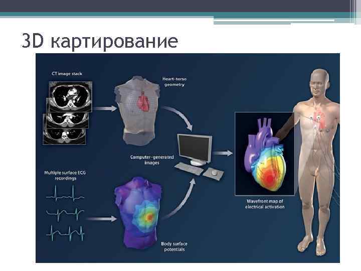 3 D картирование 