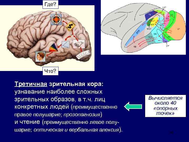 Нарушения зрительной коры