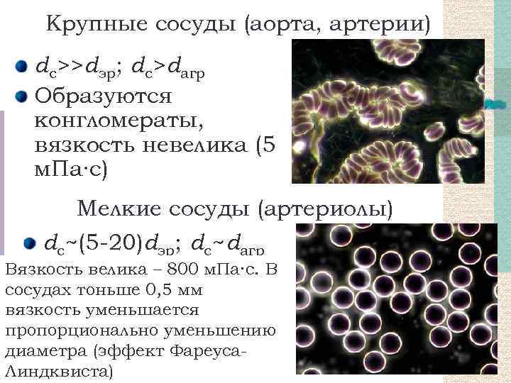 Крупные сосуды (аорта, артерии) dс>>dэр; dс>dагр Образуются конгломераты, вязкость невелика (5 м. Па∙с) Мелкие