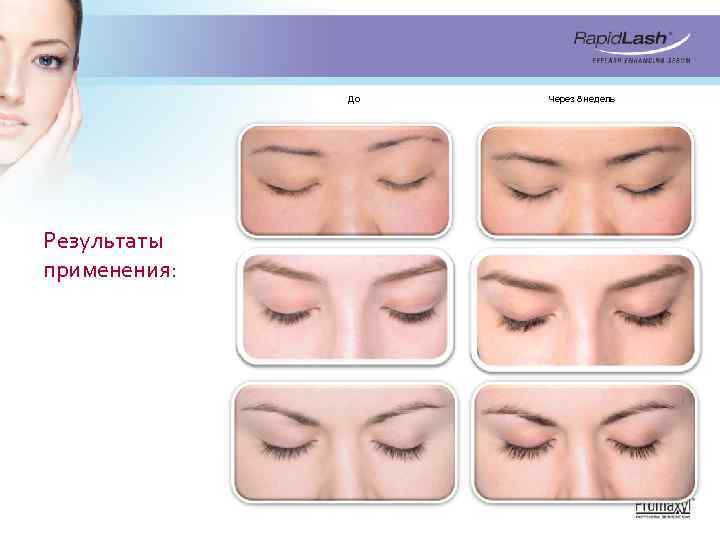 До Результаты применения: Через 8 недель 