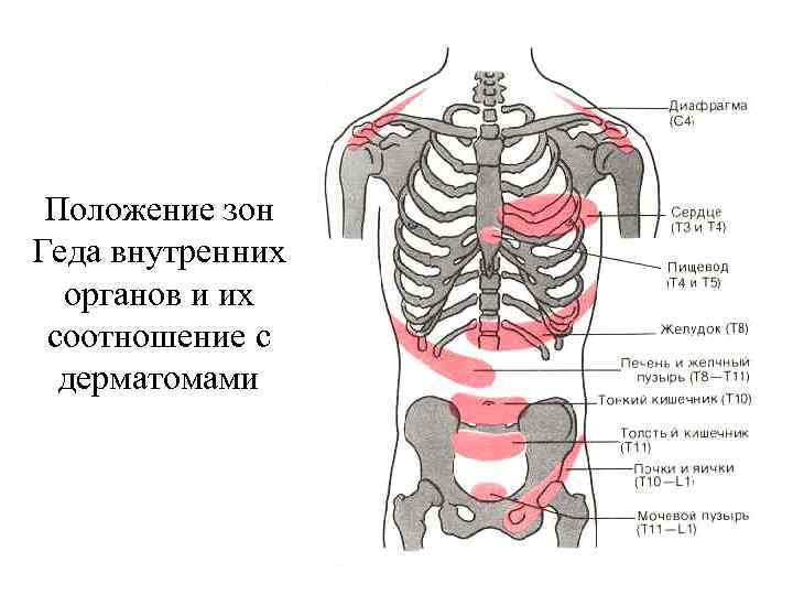 Положение зон Геда внутренних органов и их соотношение с дерматомами 