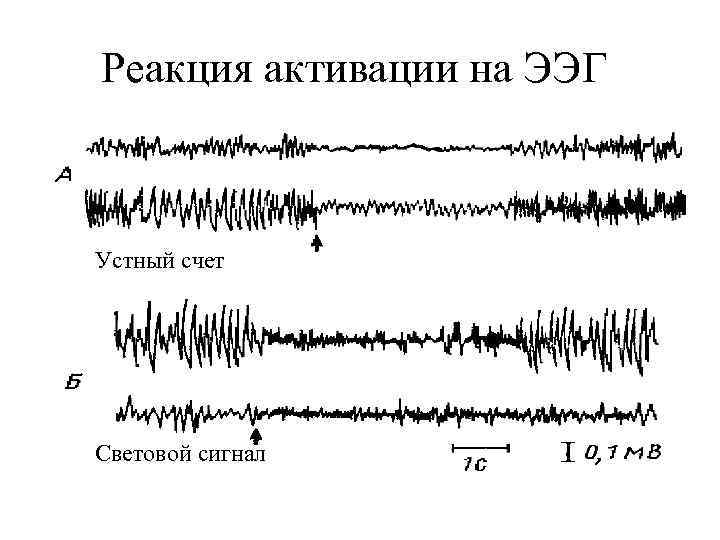 Реакция активации на ЭЭГ Устный счет Световой сигнал 