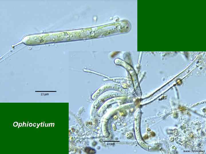 Ophiocytium 