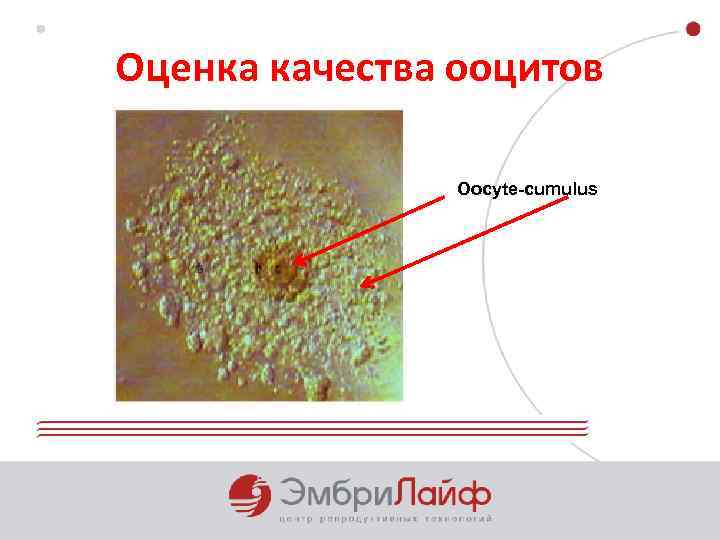 Оценка качества ооцитов Oocyte-cumulus 