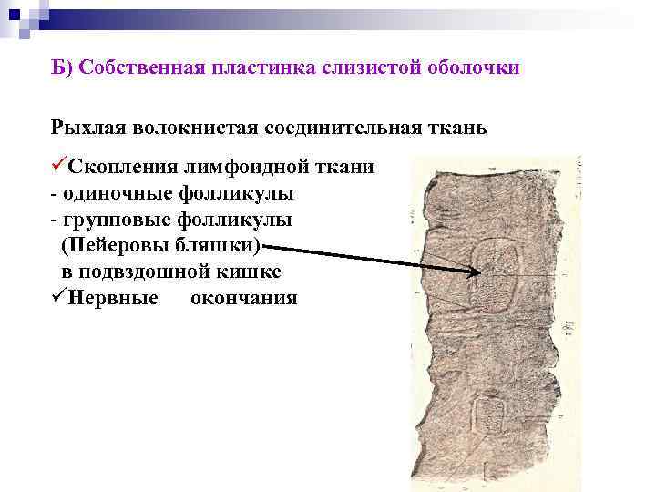 Б) Собственная пластинка слизистой оболочки Рыхлая волокнистая соединительная ткань üСкопления лимфоидной ткани - одиночные