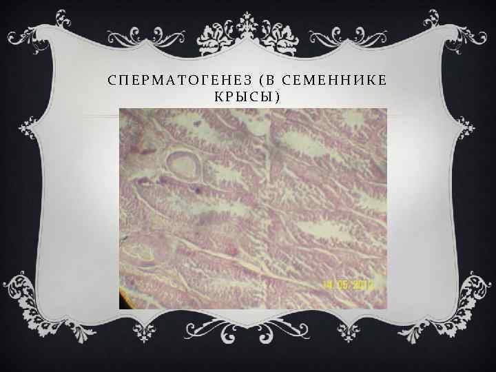 СПЕРМАТОГЕНЕЗ (В СЕМЕННИКЕ КРЫСЫ) 