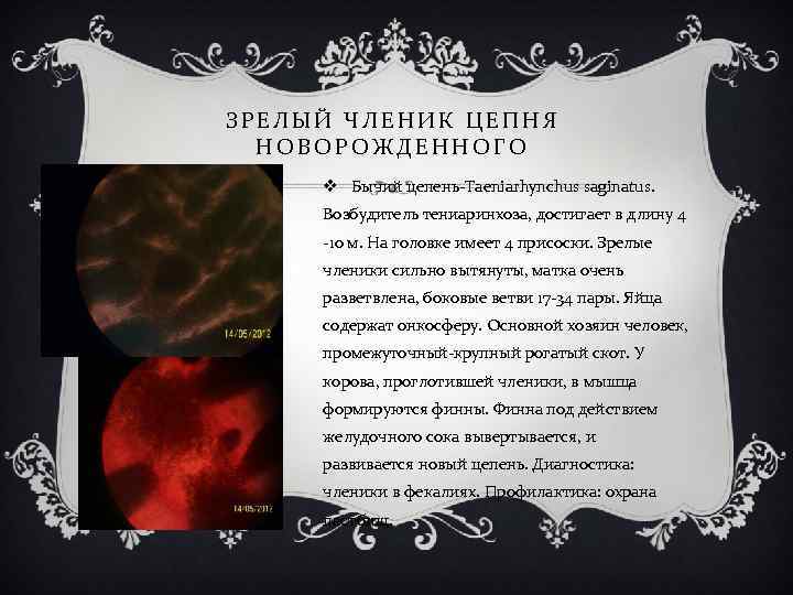 ЗРЕЛЫЙ ЧЛЕНИК ЦЕПНЯ НОВОРОЖДЕННОГО v Бычий цепень-Taeniarhynchus saginatus. Возбудитель тениаринхоза, достигает в длину 4