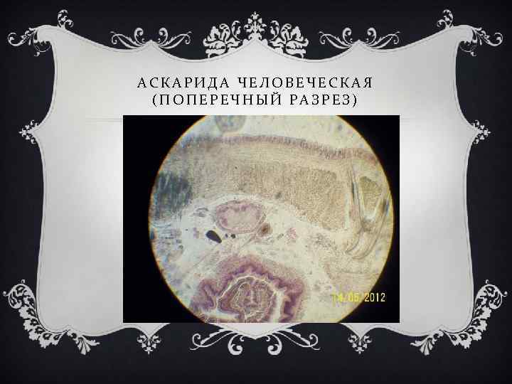 АСКАРИДА ЧЕЛОВЕЧЕСКАЯ (ПОПЕРЕЧНЫЙ РАЗРЕЗ) 