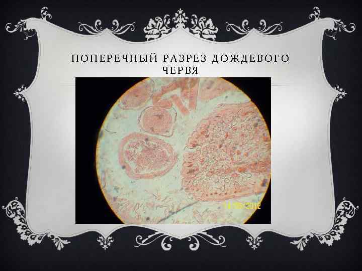 ПОПЕРЕЧНЫЙ РАЗРЕЗ ДОЖДЕВОГО ЧЕРВЯ 
