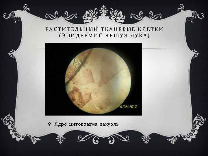 РАСТИТЕЛЬНЫЙ ТКАНЕВЫЕ КЛЕТКИ (ЭПИДЕРМИС ЧЕШУЯ ЛУКА) v Ядро, цитоплазма, вакуоль 