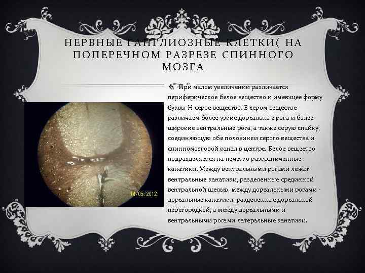 НЕРВНЫЕ ГАНГЛИОЗНЫЕ КЛЕТКИ( НА ПОПЕРЕЧНОМ РАЗРЕЗЕ СПИННОГО МОЗГА v При малом увеличении различается периферическое