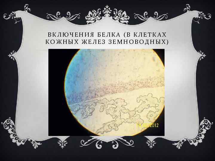 ВКЛЮЧЕНИЯ БЕЛКА (В КЛЕТКАХ КОЖНЫХ ЖЕЛЕЗ ЗЕМНОВОДНЫХ) 