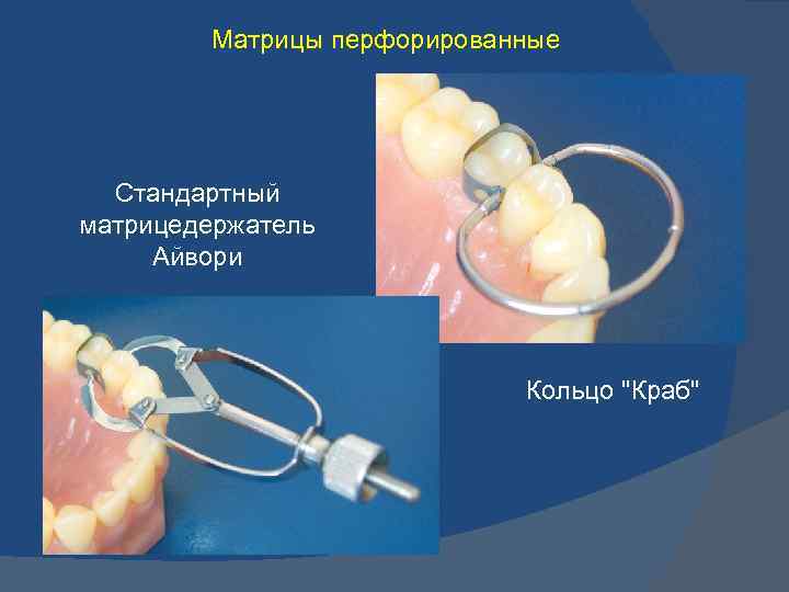 Матрицы перфорированные Стандартный матрицедержатель Айвори Кольцо 