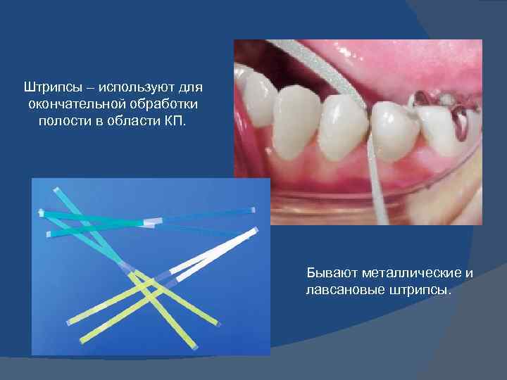 Штрипсы – используют для окончательной обработки полости в области КП. Бывают металлические и лавсановые