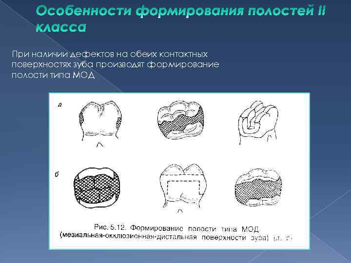 Типы полостей