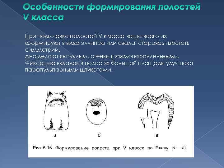 Проверить полость. Вариант формирования кариозной полости 5 класса. Общие принципы формирования полостей под вкладки. Фиксация вкладок в полости зуба. Формирование полости зуба по 1 классу.