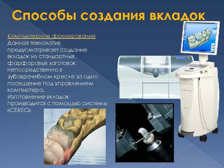 Способы создания вкладок Компьютерное фрезерование Данная технология предусматривает создание вкладок из стандартных фарфоровых заготовок