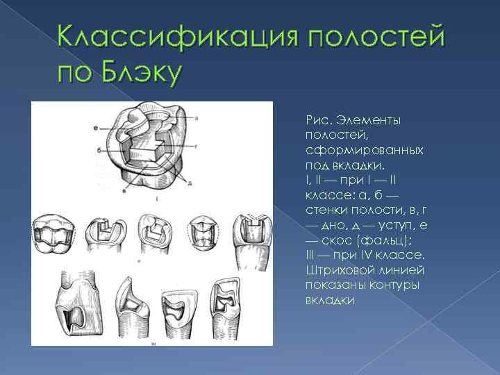 Классификация полостей