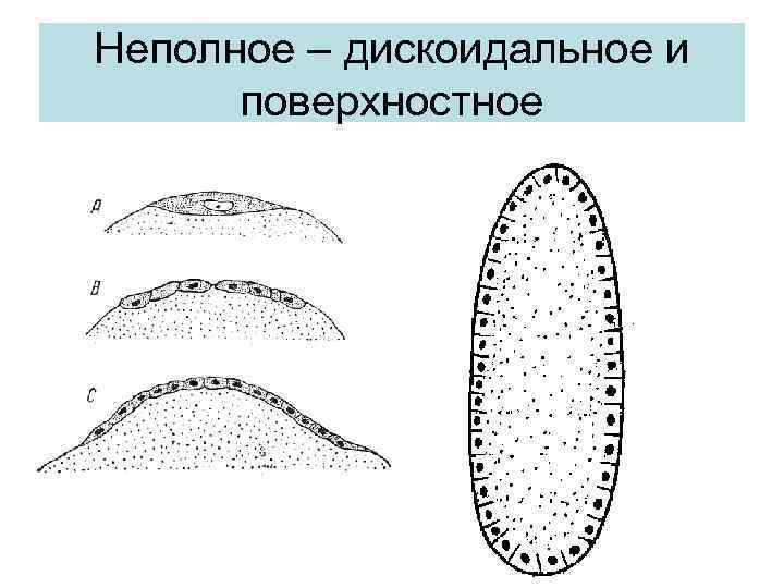 Неполное – дискоидальное и поверхностное 