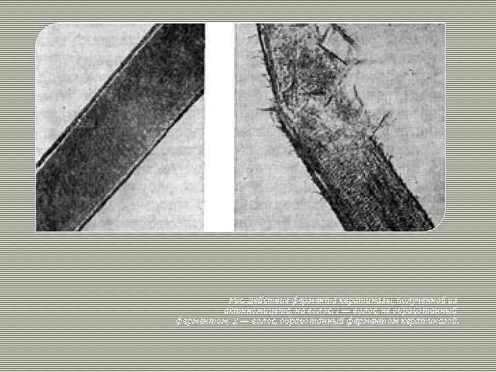 Рис. Действие фермента кератиназы, полученной из актнномицета, на волос: I — волос, не обработанный