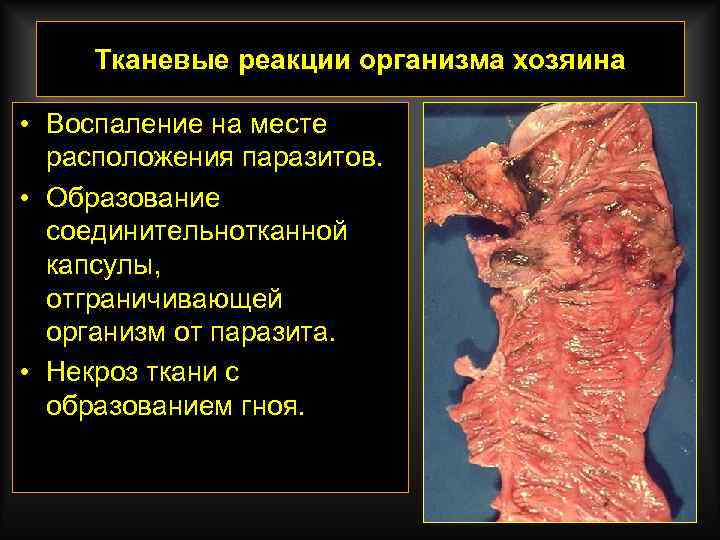 Тканевые реакции организма хозяина • Воспаление на месте расположения паразитов. • Образование соединительнотканной капсулы,