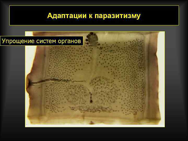 Адаптации к паразитизму Упрощение систем органов 