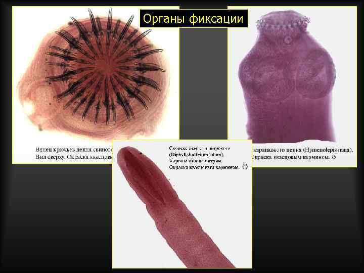 Органы фиксации 